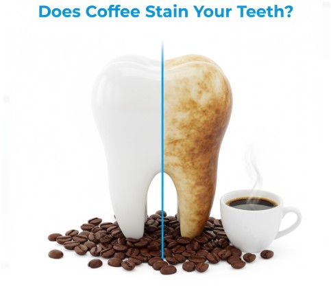 How Exactly Do Coffee Stains Form on Teeth?